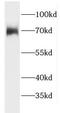 FAST Kinase Domains 3 antibody, FNab03021, FineTest, Western Blot image 