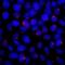 5-azacytidine-induced protein 1 antibody, NB100-68225, Novus Biologicals, Immunofluorescence image 