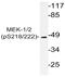 Mitogen-Activated Protein Kinase Kinase 1 antibody, AP20822PU-N, Origene, Western Blot image 