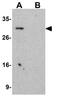 BTB/POZ domain-containing protein KCTD15 antibody, GTX31374, GeneTex, Western Blot image 