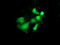 Pyrroline-5-Carboxylate Reductase 3 antibody, M32428-2, Boster Biological Technology, Immunofluorescence image 
