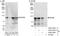 Ubiquitin Interaction Motif Containing 1 antibody, A300-763A, Bethyl Labs, Immunoprecipitation image 