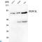 Phosphoenolpyruvate Carboxykinase 2, Mitochondrial antibody, LS-C813078, Lifespan Biosciences, Western Blot image 