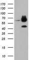 Epoxide Hydrolase 2 antibody, CF501627, Origene, Western Blot image 