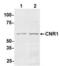 Cannabinoid Receptor 1 antibody, 54-332, ProSci, Western Blot image 