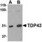 TAR DNA Binding Protein antibody, TA306454, Origene, Western Blot image 