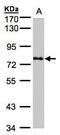 Polypeptide N-acetylgalactosaminyltransferase 6 antibody, PA5-28064, Invitrogen Antibodies, Western Blot image 