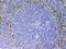Endoglin antibody, PA5-79203, Invitrogen Antibodies, Immunohistochemistry frozen image 