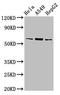 Transducin Beta Like 1 X-Linked antibody, LS-C672081, Lifespan Biosciences, Western Blot image 