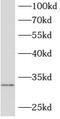 ATP Synthase Mitochondrial F1 Complex Assembly Factor 2 antibody, FNab00732, FineTest, Western Blot image 