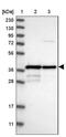 Mitochondrial RRNA Methyltransferase 1 antibody, NBP1-83597, Novus Biologicals, Western Blot image 