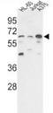 Protein Phosphatase 3 Catalytic Subunit Gamma antibody, AP31353PU-N, Origene, Western Blot image 