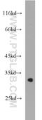 Leucine Rich Repeat Containing 10 antibody, 21575-1-AP, Proteintech Group, Western Blot image 