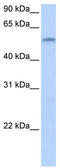 Zinc Finger Protein 280A antibody, TA339785, Origene, Western Blot image 