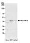 NADH:Ubiquinone Oxidoreductase Subunit A10 antibody, A305-464A, Bethyl Labs, Western Blot image 