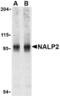 NLR Family Pyrin Domain Containing 2 antibody, TA306102, Origene, Western Blot image 