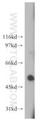 Galactosylceramidase antibody, 12887-1-AP, Proteintech Group, Western Blot image 