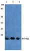 ATP Synthase Membrane Subunit F antibody, PA5-75434, Invitrogen Antibodies, Western Blot image 