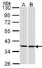 Family With Sequence Similarity 50 Member A antibody, GTX106590, GeneTex, Western Blot image 