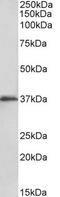 Musashi RNA Binding Protein 2 antibody, TA334179, Origene, Western Blot image 