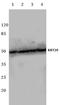Keratin 20 antibody, AP06202PU-N, Origene, Western Blot image 