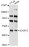 UDP-GlcNAc:betaGal beta-1,3-N-acetylglucosaminyltransferase 5 antibody, LS-C749430, Lifespan Biosciences, Western Blot image 