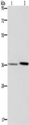 MAGE Family Member F1 antibody, TA351377, Origene, Western Blot image 