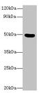 Chromosome 5 Open Reading Frame 22 antibody, CSB-PA675468LA01HU, Cusabio, Western Blot image 