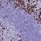 Plasma cell-induced resident endoplasmic reticulum protein antibody, NBP1-92287, Novus Biologicals, Immunohistochemistry frozen image 