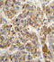 Methylcrotonoyl-CoA Carboxylase 2 antibody, 62-540, ProSci, Immunohistochemistry paraffin image 