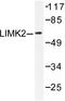 LIM Domain Kinase 2 antibody, AP06211PU-N, Origene, Western Blot image 