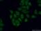 Androgen Receptor antibody, 22576-1-AP, Proteintech Group, Immunofluorescence image 