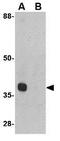 Autophagy Related 12 antibody, GTX31769, GeneTex, Western Blot image 