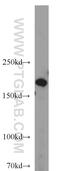 Dedicator Of Cytokinesis 1 antibody, 23421-1-AP, Proteintech Group, Western Blot image 
