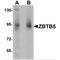 Zinc Finger And BTB Domain Containing 5 antibody, MBS150141, MyBioSource, Western Blot image 