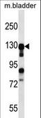 Myocardin Related Transcription Factor B antibody, LS-C164210, Lifespan Biosciences, Western Blot image 