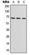 Hypermethylated in cancer 2 protein antibody, LS-C353344, Lifespan Biosciences, Western Blot image 