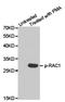 Rac Family Small GTPase 1 antibody, TA327599, Origene, Western Blot image 
