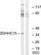 Zinc Finger DHHC-Type Containing 15 antibody, TA316181, Origene, Western Blot image 