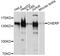Calcium Homeostasis Endoplasmic Reticulum Protein antibody, A9702, ABclonal Technology, Western Blot image 