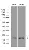 RecQ Mediated Genome Instability 2 antibody, LS-C796654, Lifespan Biosciences, Western Blot image 