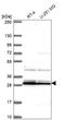 Guanylate Cyclase Activator 1B antibody, HPA055479, Atlas Antibodies, Western Blot image 