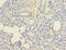 Ubiquitin-conjugating enzyme E2 G2 antibody, A61630-100, Epigentek, Immunohistochemistry paraffin image 