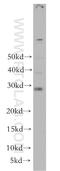 RAB12, Member RAS Oncogene Family antibody, 18843-1-AP, Proteintech Group, Western Blot image 