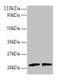 ADP Ribosylation Factor Like GTPase 2 antibody, LS-C211104, Lifespan Biosciences, Western Blot image 