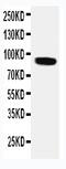 Transient Receptor Potential Cation Channel Subfamily V Member 2 antibody, PA1977, Boster Biological Technology, Western Blot image 