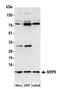 Signal Recognition Particle 9 antibody, NBP2-61107, Novus Biologicals, Western Blot image 