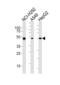 Aldehyde dehydrogenase, mitochondrial antibody, LS-C156258, Lifespan Biosciences, Western Blot image 