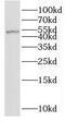 RING finger protein 38 antibody, FNab07356, FineTest, Western Blot image 