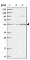 2-Hydroxyacyl-CoA Lyase 1 antibody, PA5-57295, Invitrogen Antibodies, Western Blot image 